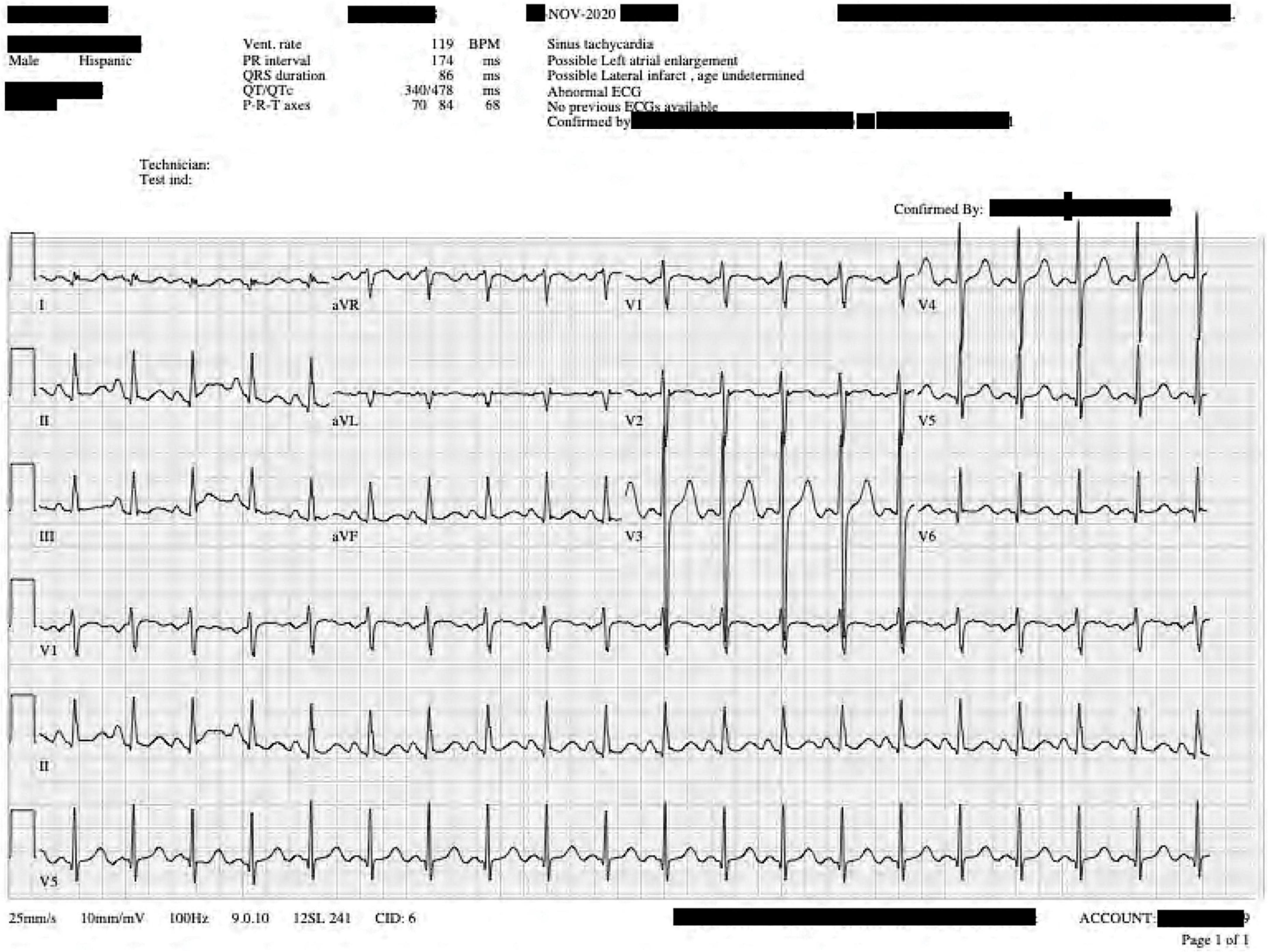 Cardiac arrest associated with non-toxigenic corynebacterium diphtheria strain: A case report